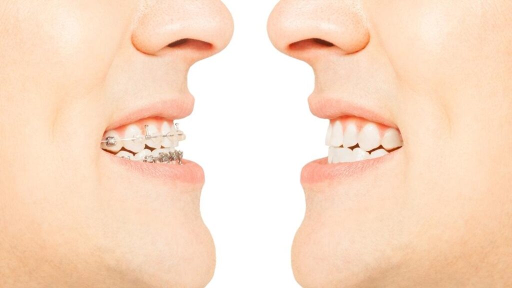 mersin ortodonti (2)